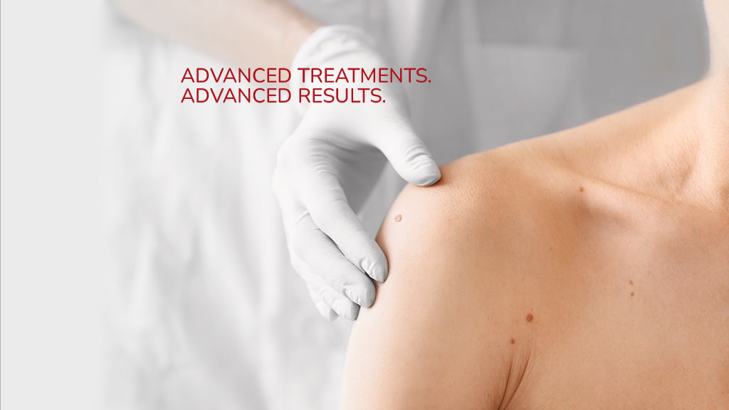 Dermatologist examining patient's skin at Advanced Dermatology Center in Burbank