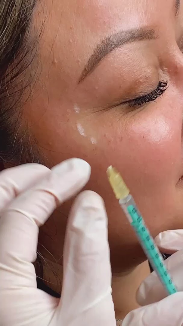 Cosmetic injection treatment being administered at Advanced Dermatology Center