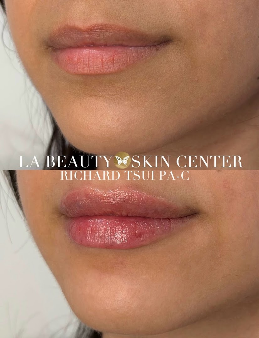 LA Beauty Skin Center treatment room