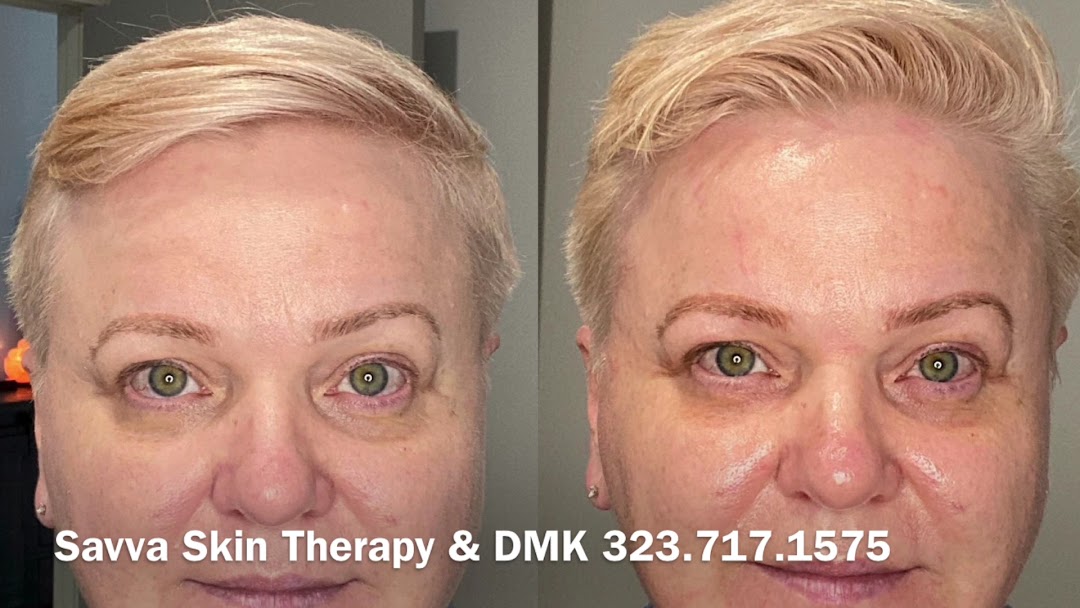 Savva Skin Therapy products